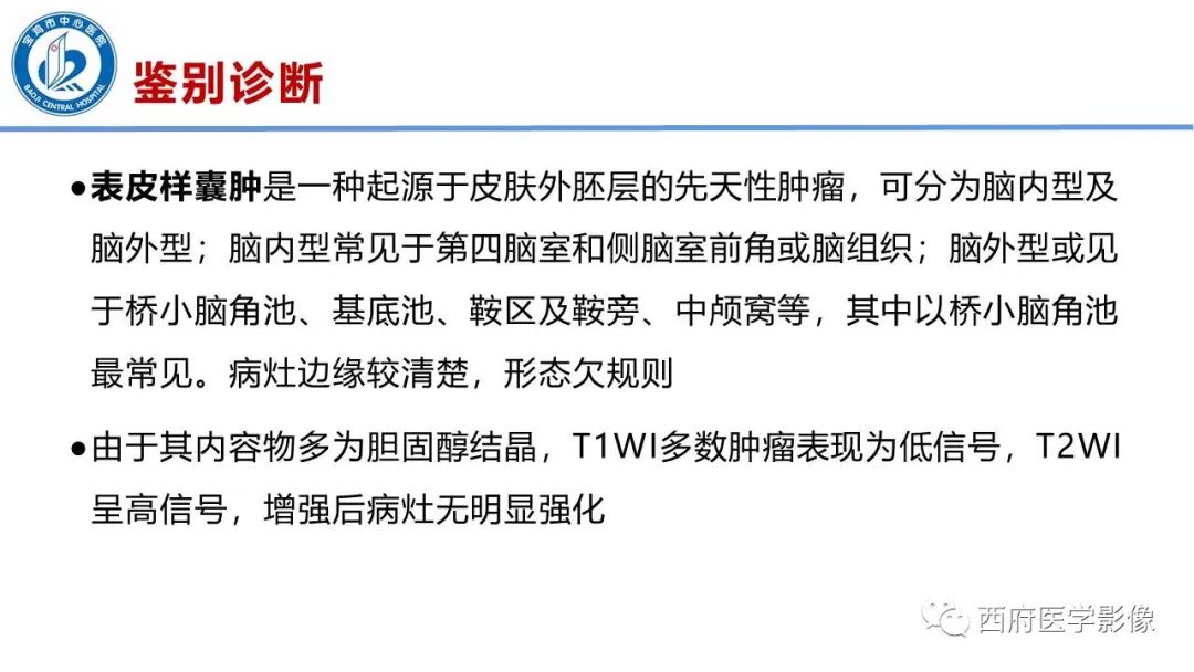 影像PPT - 【病例】脑室系统脑膜瘤1例CT及MR影像表现与鉴别-22