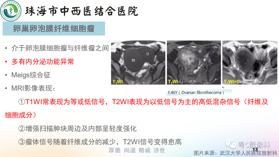 影像PPT - 【PPT】女性附件区T2WI低信号病变影像诊断分析-13