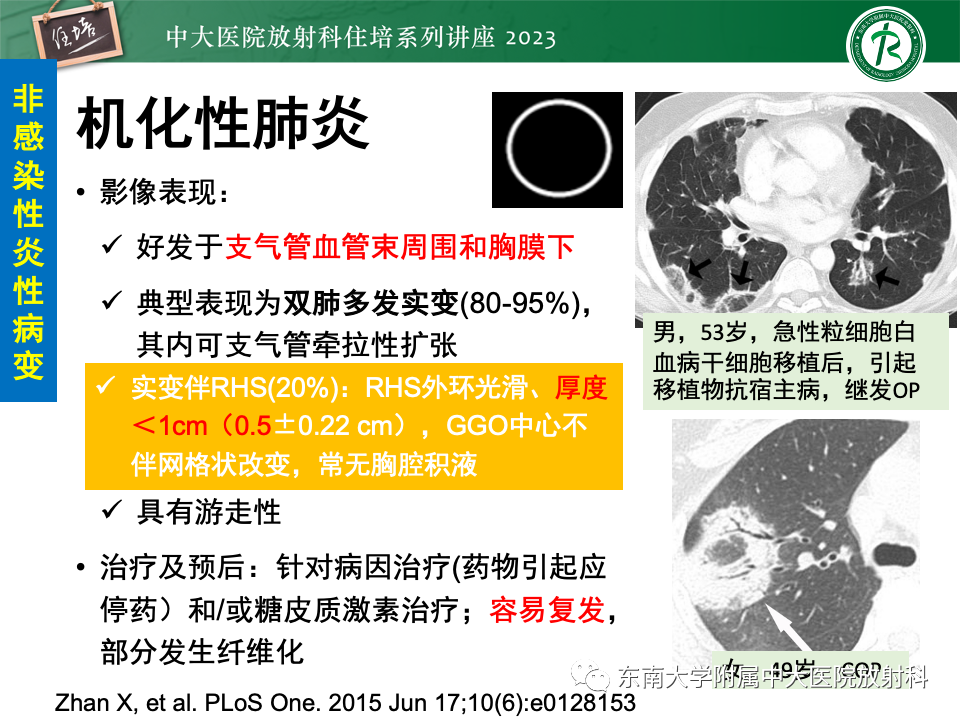 影像PPT - 【PPT】 胸部“反晕征”相关病变及鉴别-9
