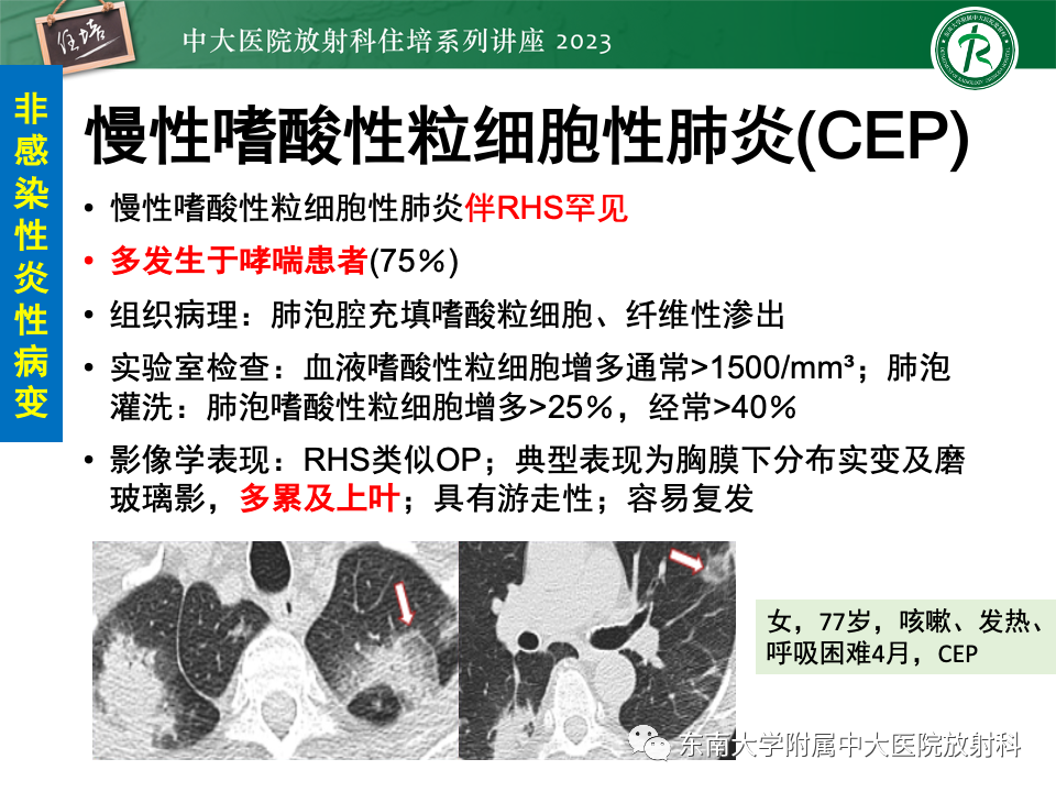 影像PPT - 【PPT】 胸部“反晕征”相关病变及鉴别-11