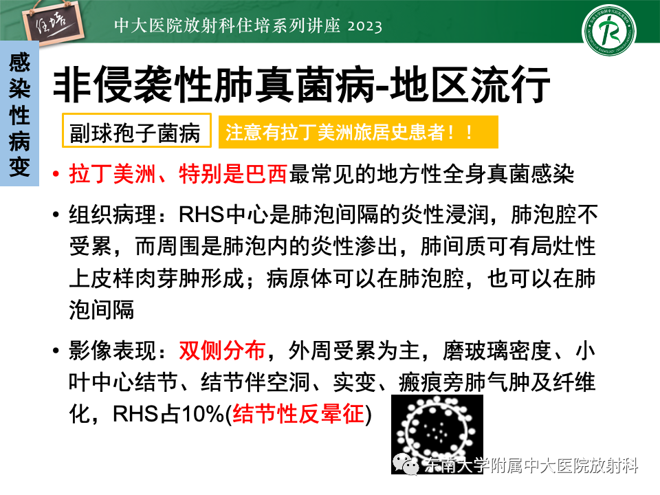 影像PPT - 【PPT】 胸部“反晕征”相关病变及鉴别-21