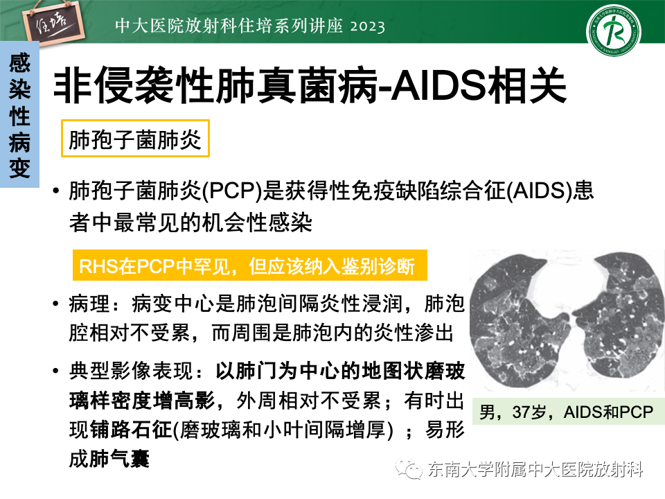 影像PPT - 【PPT】 胸部“反晕征”相关病变及鉴别-24