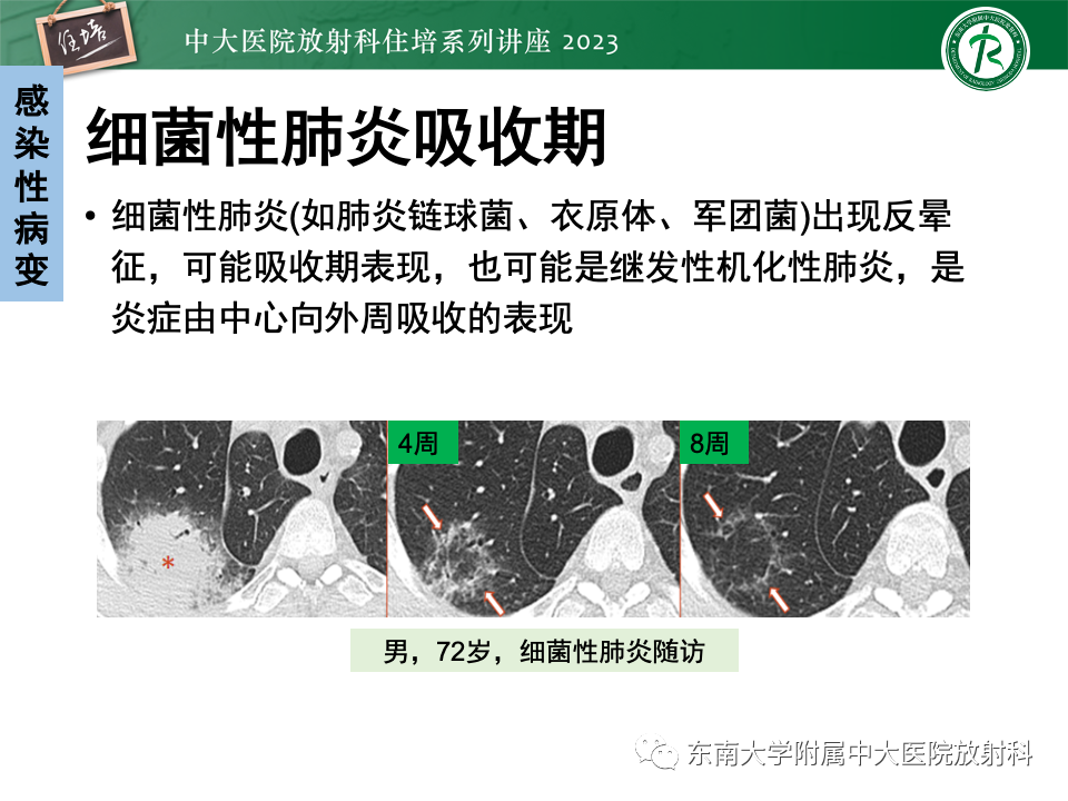 影像PPT - 【PPT】 胸部“反晕征”相关病变及鉴别-26