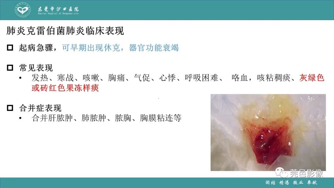 影像PPT - 【PPT】肺炎克雷伯杆菌肺炎影像学诊断与鉴别诊断-23