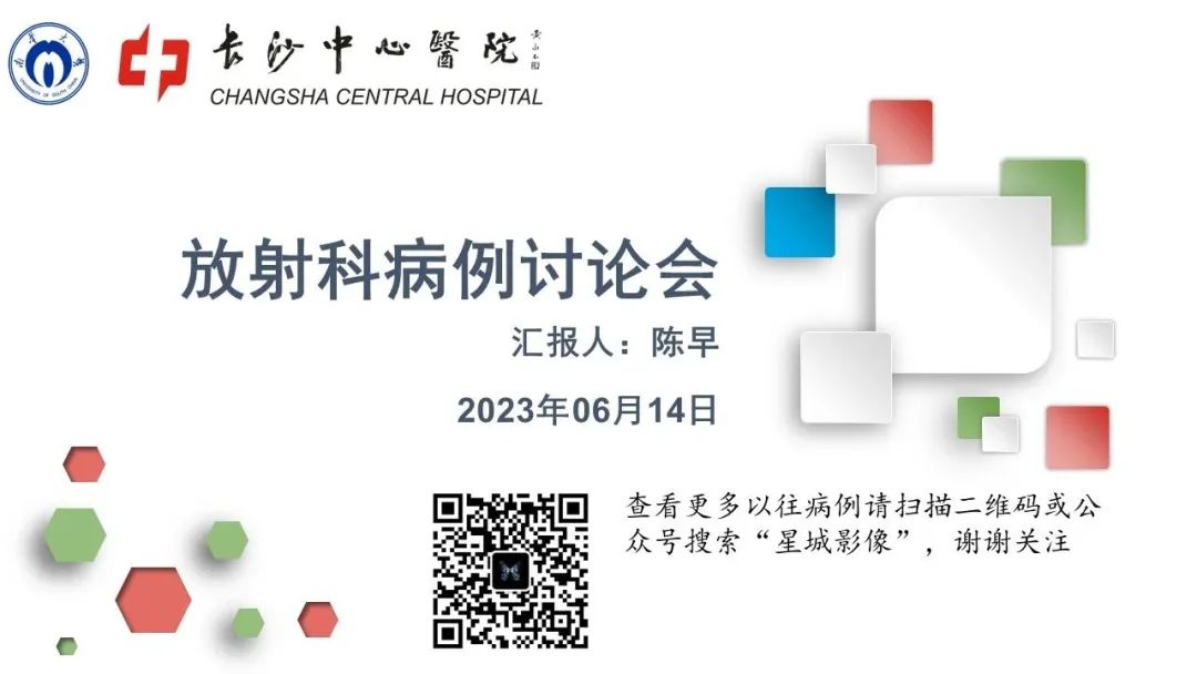 影像PPT - 【病例】颅底骨化性纤维瘤1例CT及MR影像-1 影像PPT - 【病例】颅底骨化性纤维瘤1例CT及MR影像-1