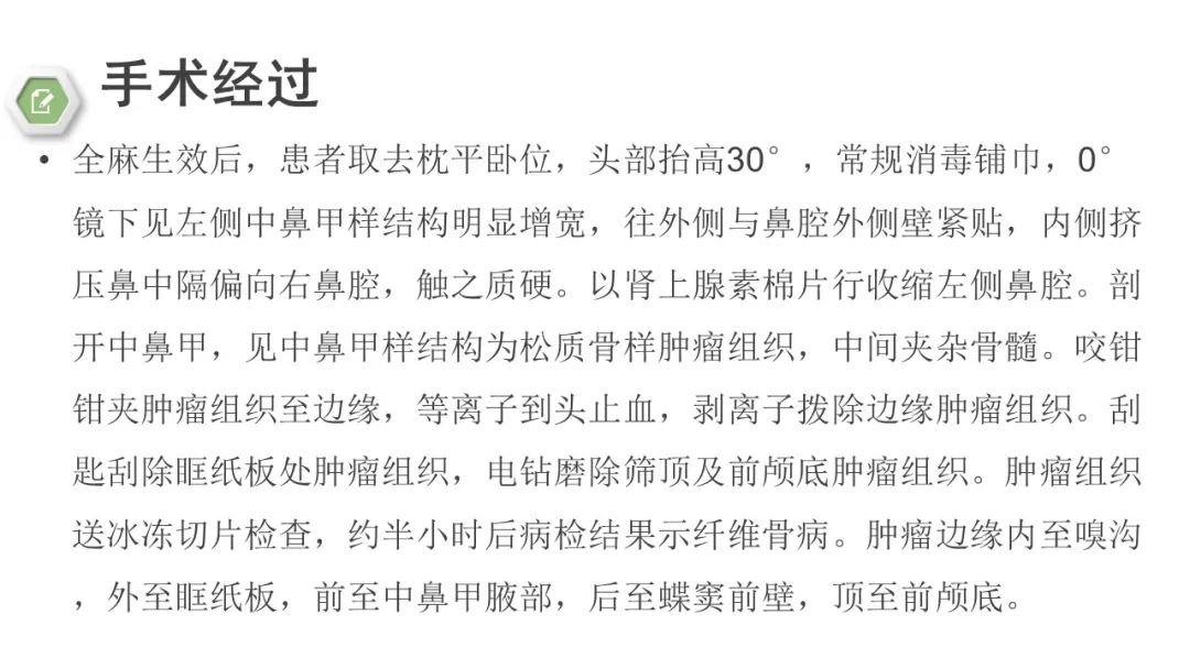 影像PPT - 【病例】颅底骨化性纤维瘤1例CT及MR影像-14 影像PPT - 【病例】颅底骨化性纤维瘤1例CT及MR影像-14