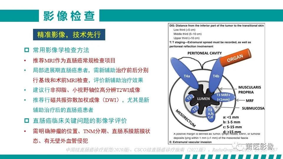 影像PPT - 【PPT】直肠癌影像学评价-12