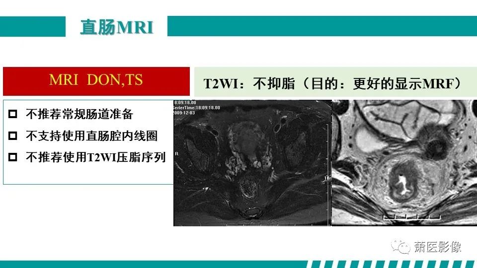 影像PPT - 【PPT】直肠癌影像学评价-19