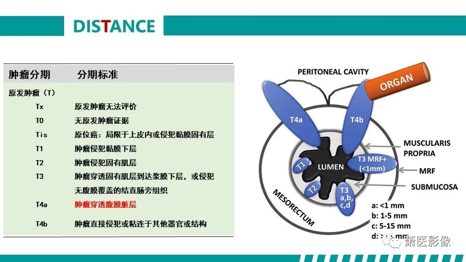 影像PPT - 【PPT】直肠癌影像学评价-29