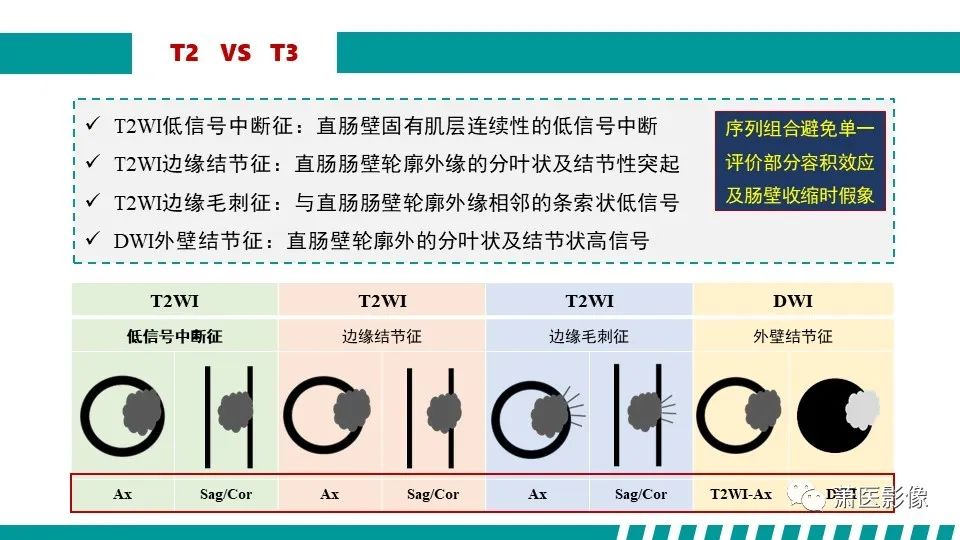 影像PPT - 【PPT】直肠癌影像学评价-35