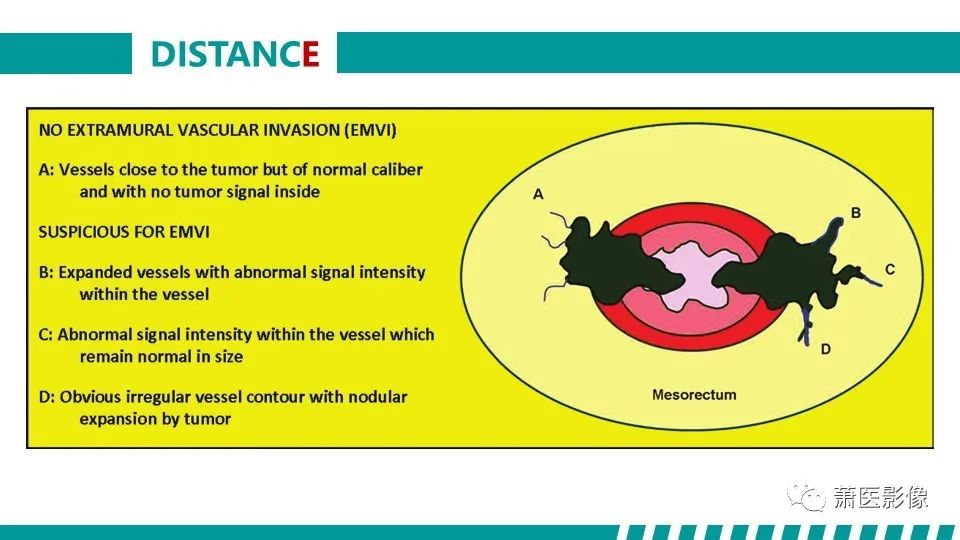 影像PPT - 【PPT】直肠癌影像学评价-57