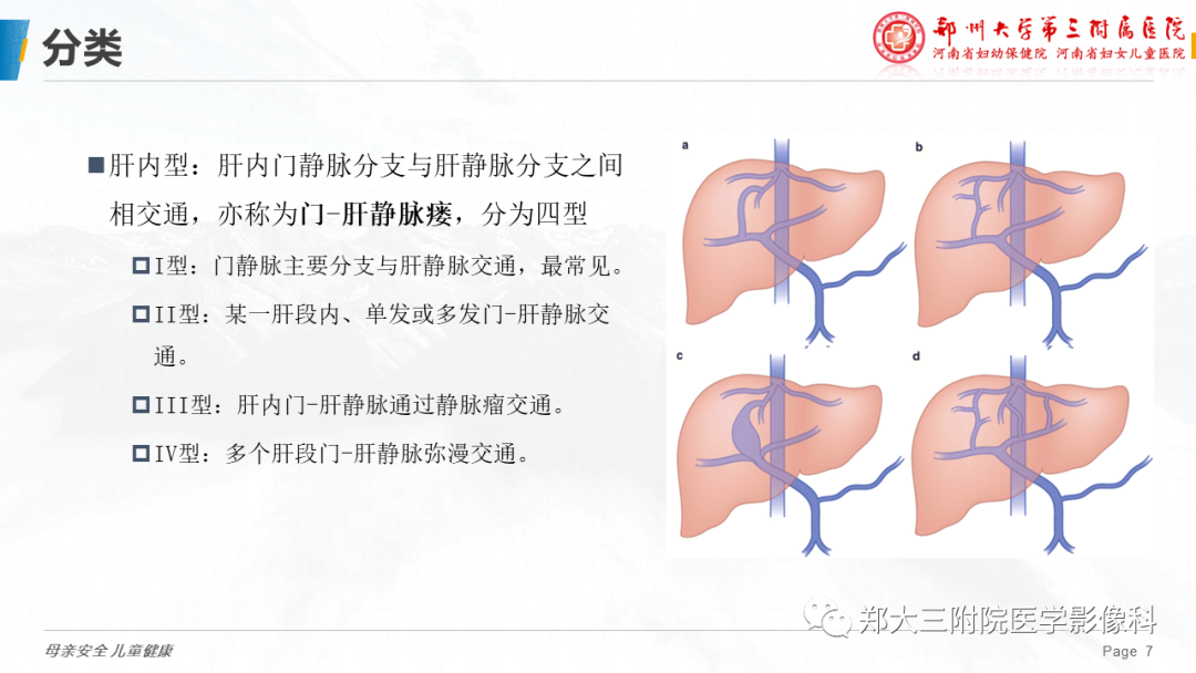 影像PPT - 【PPT】先天性门体静脉分流-7