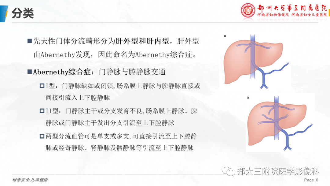 影像PPT - 【PPT】先天性门体静脉分流-6