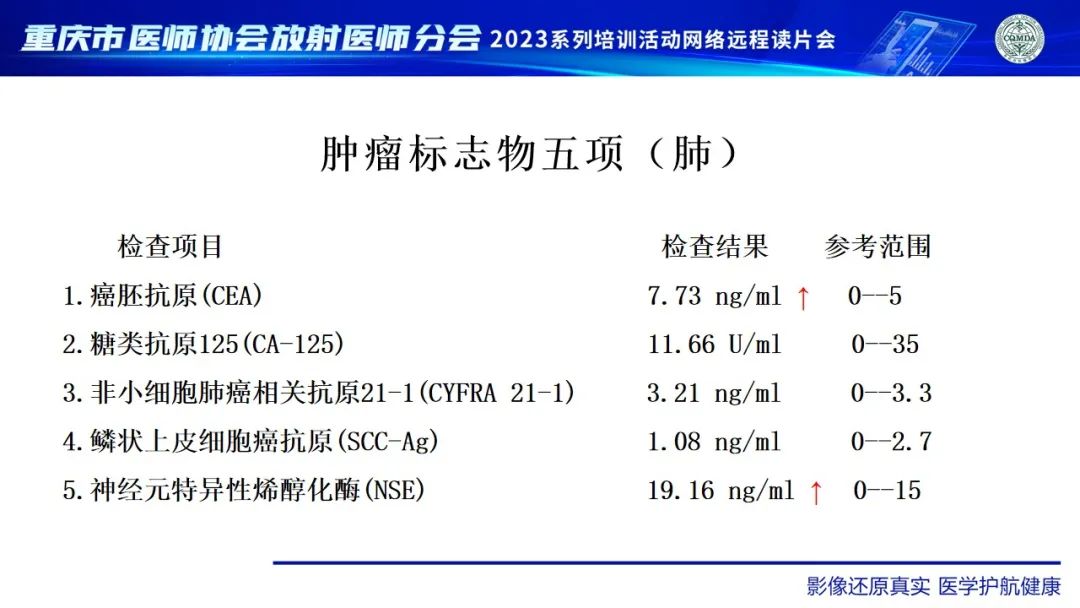 影像PPT - 【病例】肺大细胞神经内分泌癌1例CT影像-3