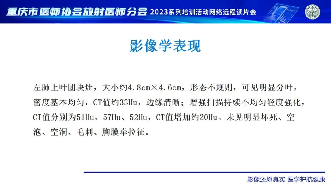 影像PPT - 【病例】肺大细胞神经内分泌癌1例CT影像-12