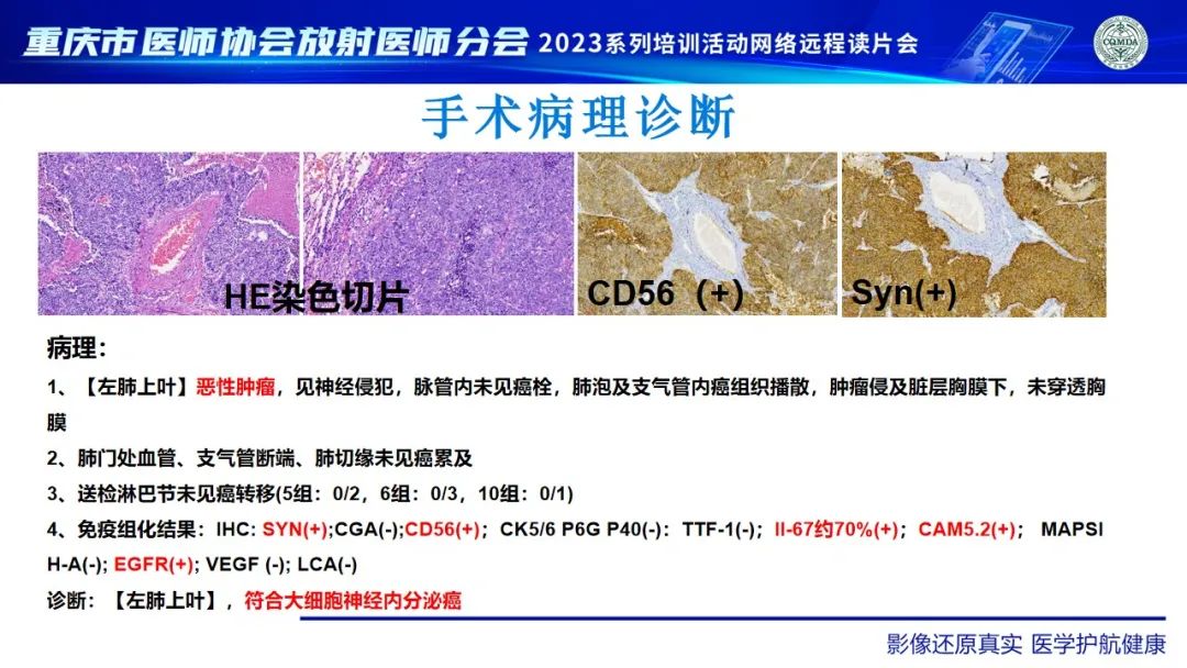 影像PPT - 【病例】肺大细胞神经内分泌癌1例CT影像-14