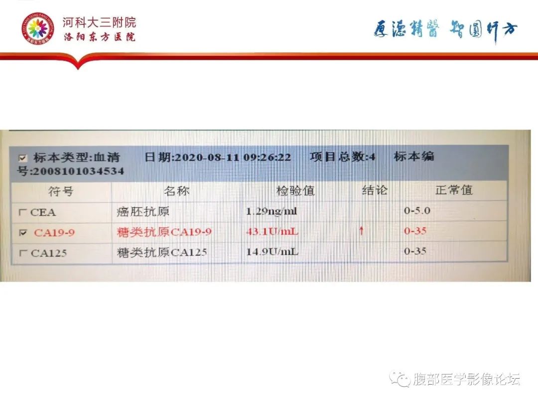 影像PPT - 【病例】静脉内平滑肌瘤病1例CT及MR影像-4