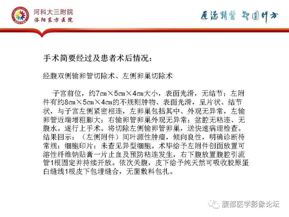 影像PPT - 【病例】静脉内平滑肌瘤病1例CT及MR影像-29