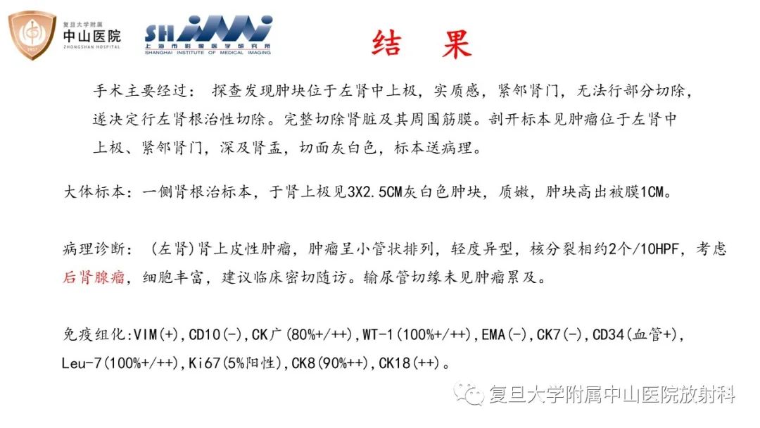 影像PPT - 【病例】后肾腺瘤1例MR影像诊断与鉴别-5