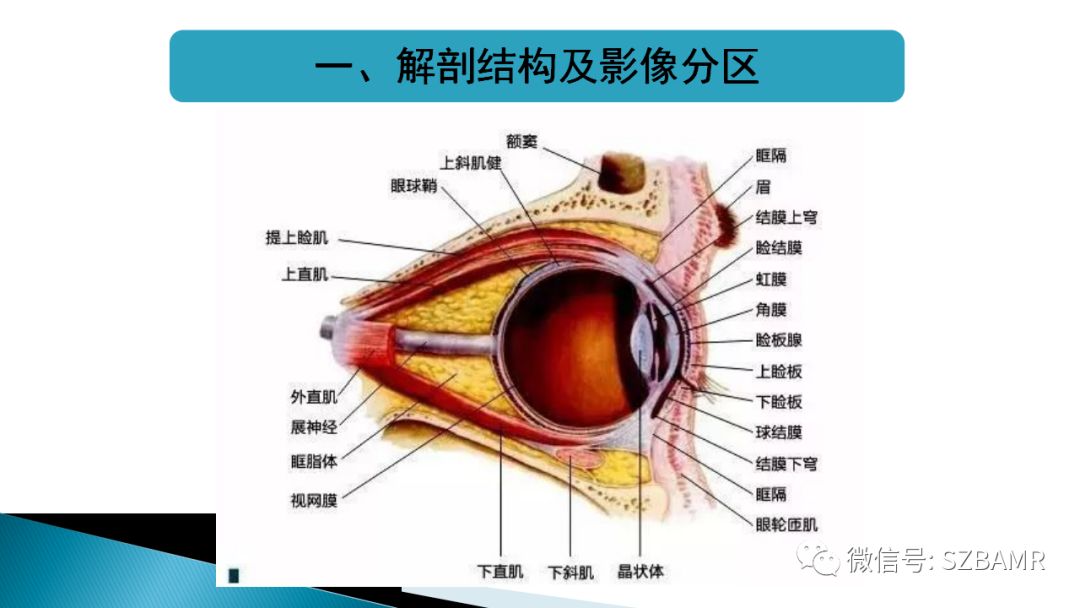 影像PPT - 【PPT】眼眶常见肿瘤的影像表现-3