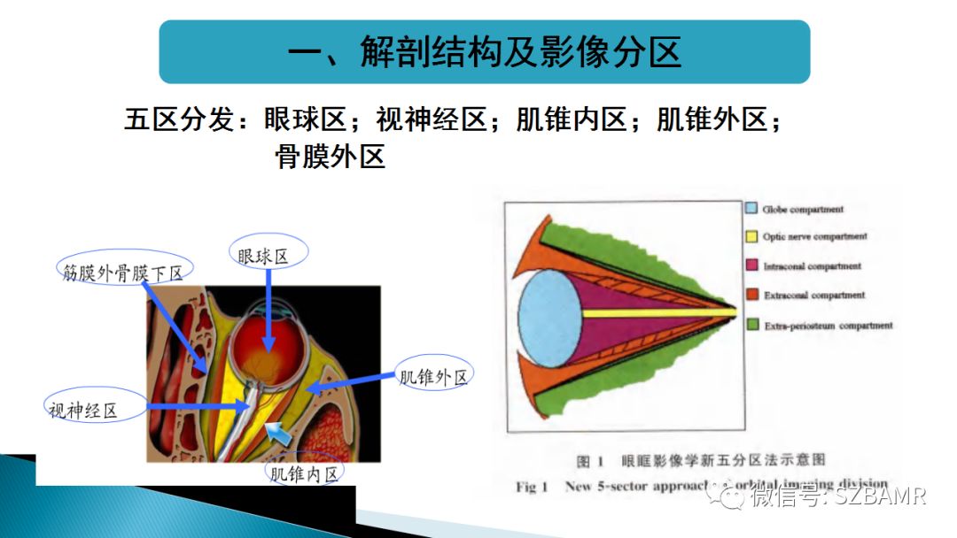 影像PPT - 【PPT】眼眶常见肿瘤的影像表现-4