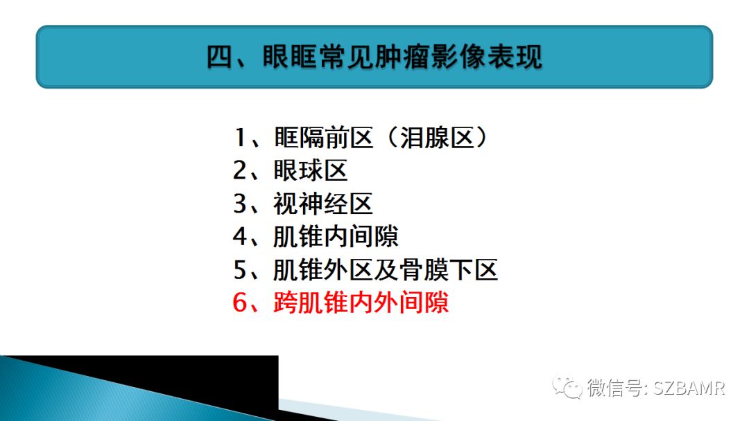 影像PPT - 【PPT】眼眶常见肿瘤的影像表现-41