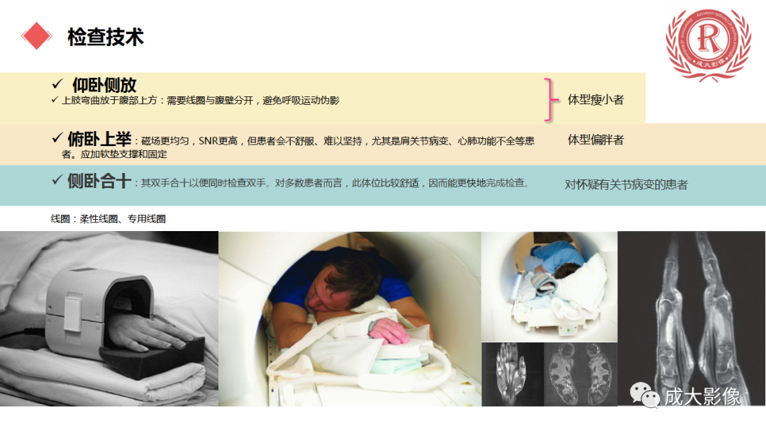 影像PPT - 【PPT】腕关节MRI解剖与临床-4