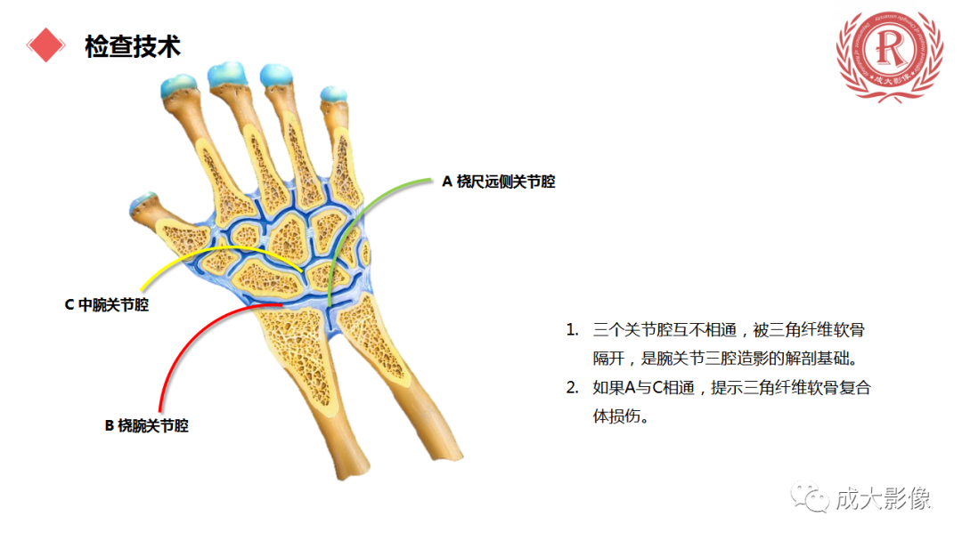 影像PPT - 【PPT】腕关节MRI解剖与临床-7