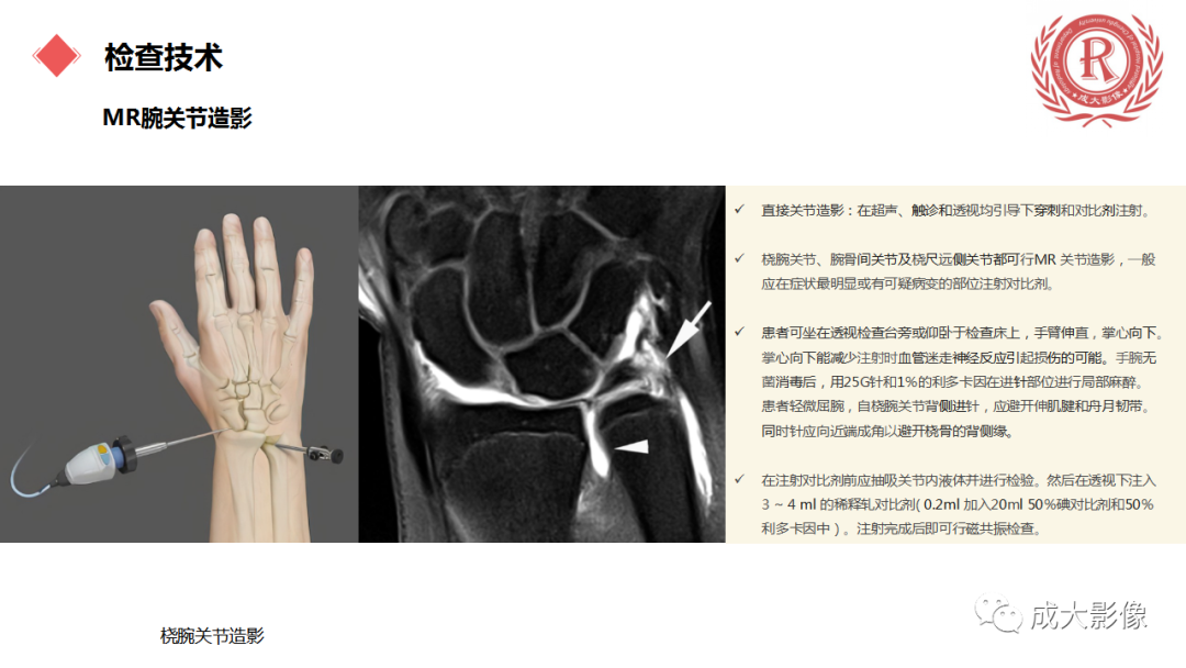 影像PPT - 【PPT】腕关节MRI解剖与临床-9