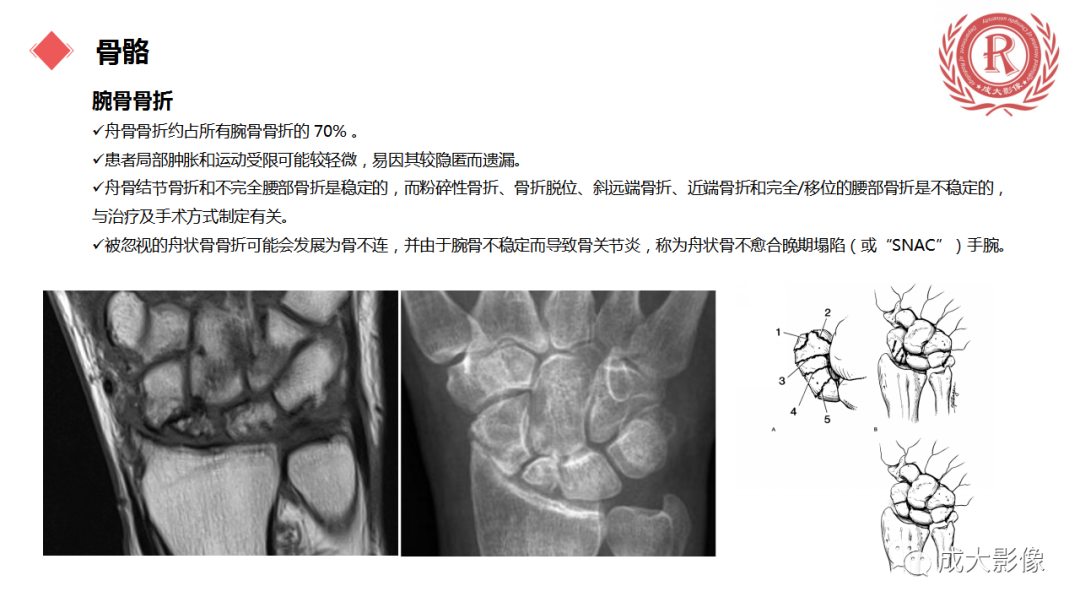 影像PPT - 【PPT】腕关节MRI解剖与临床-14
