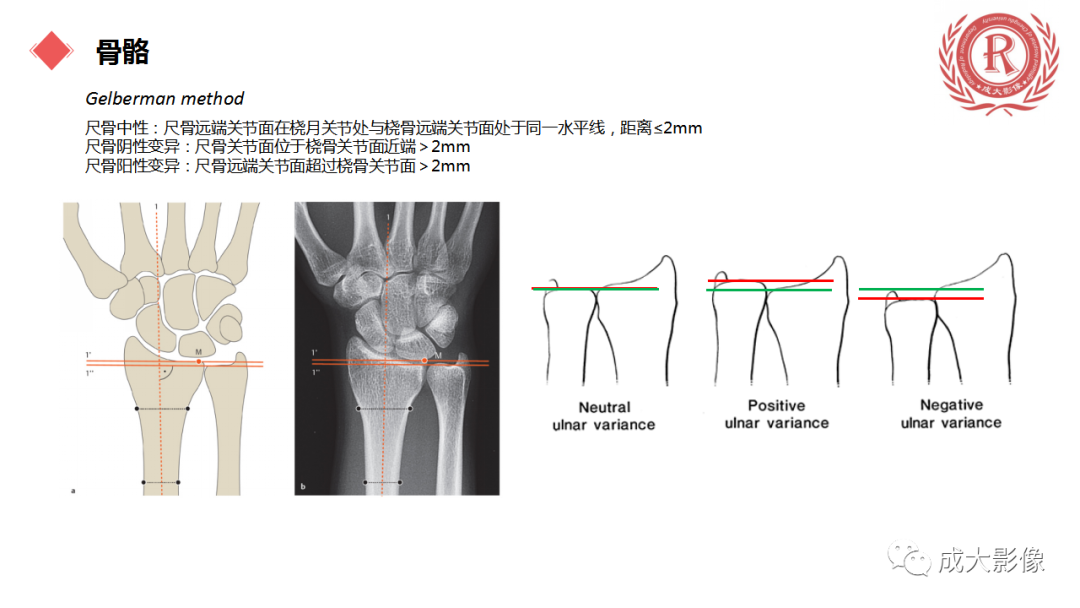 影像PPT - 【PPT】腕关节MRI解剖与临床-15