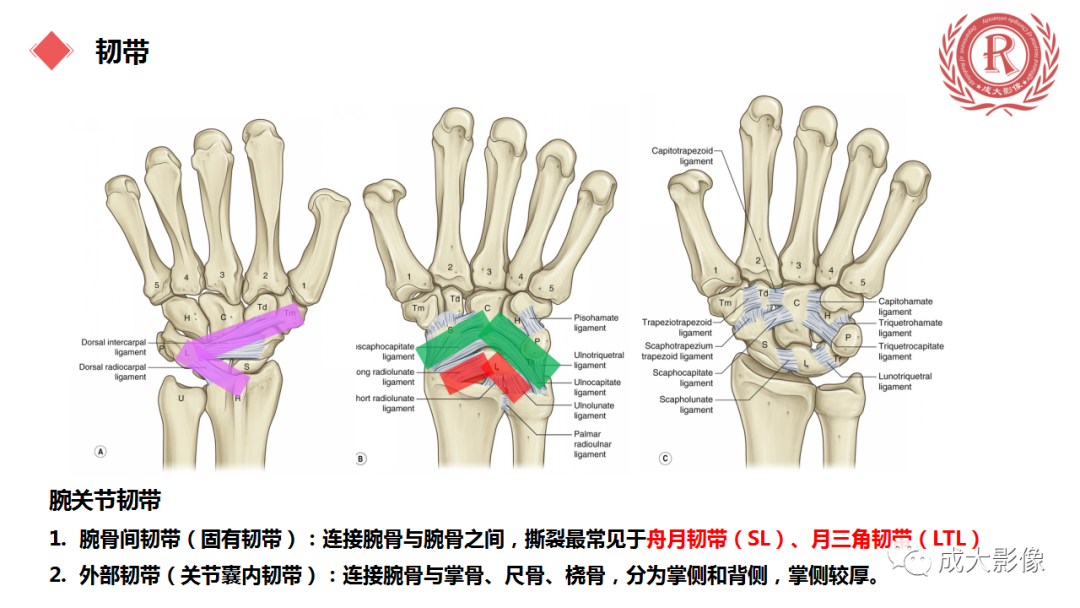 影像PPT - 【PPT】腕关节MRI解剖与临床-18