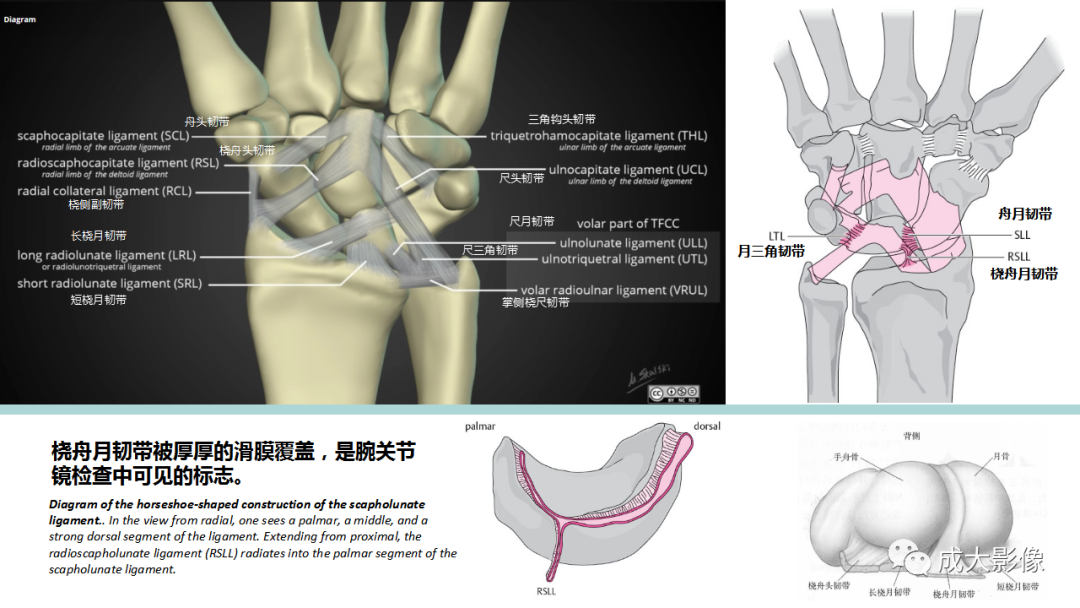 影像PPT - 【PPT】腕关节MRI解剖与临床-20