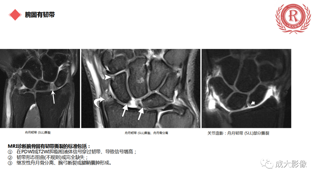 影像PPT - 【PPT】腕关节MRI解剖与临床-29