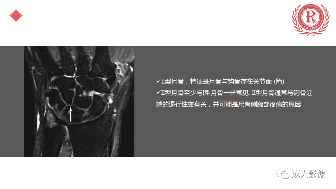 影像PPT - 【PPT】腕关节MRI解剖与临床-32