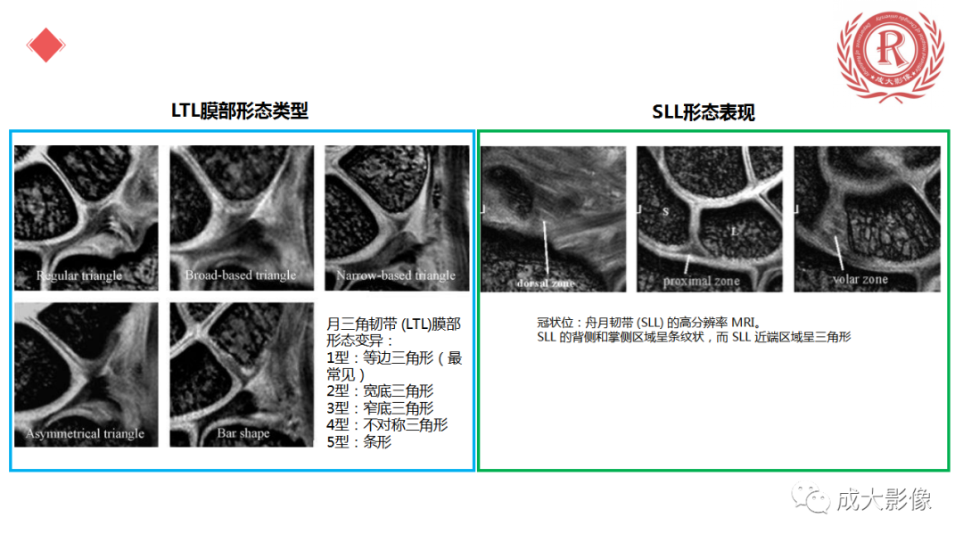 影像PPT - 【PPT】腕关节MRI解剖与临床-34
