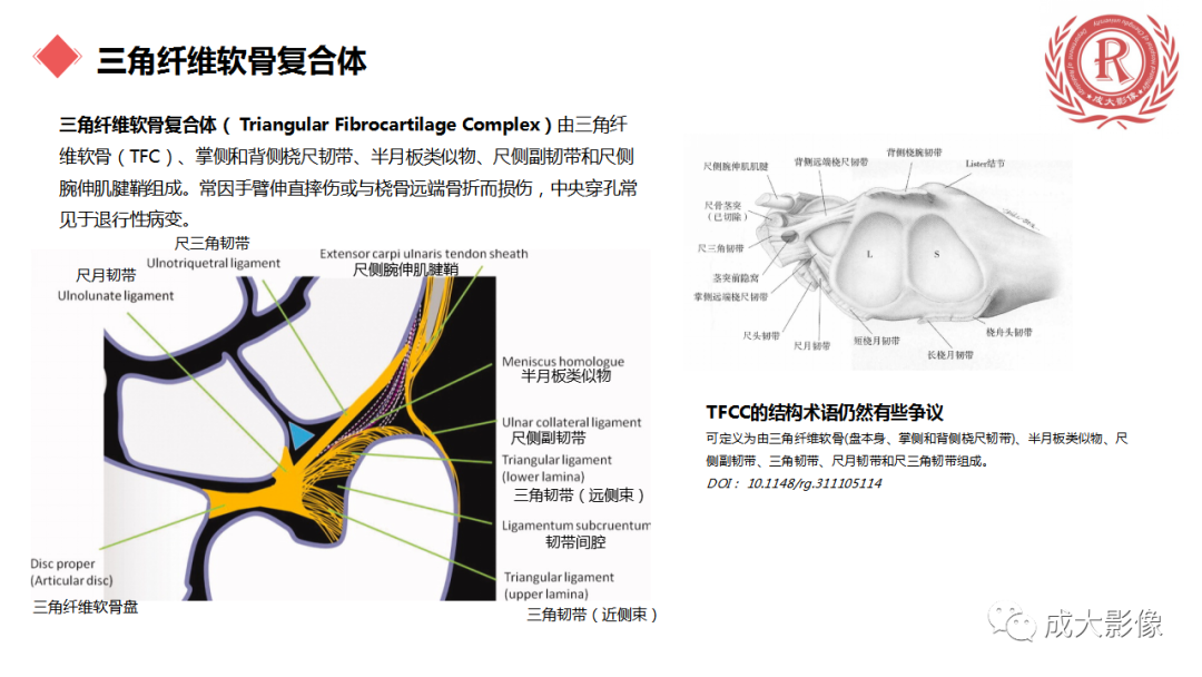 影像PPT - 【PPT】腕关节MRI解剖与临床-37