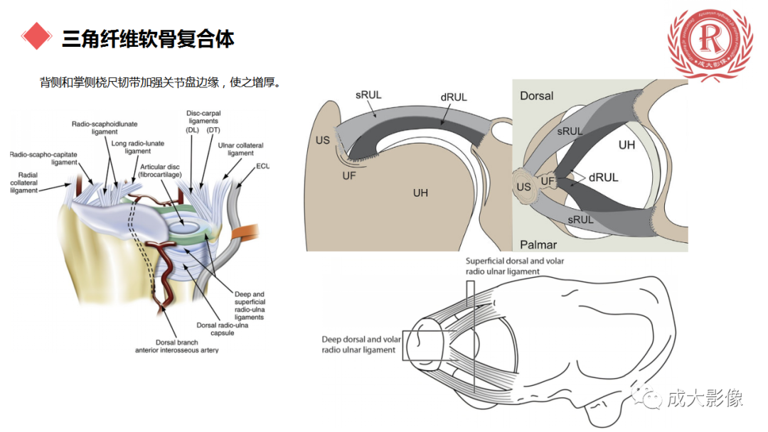 影像PPT - 【PPT】腕关节MRI解剖与临床-39
