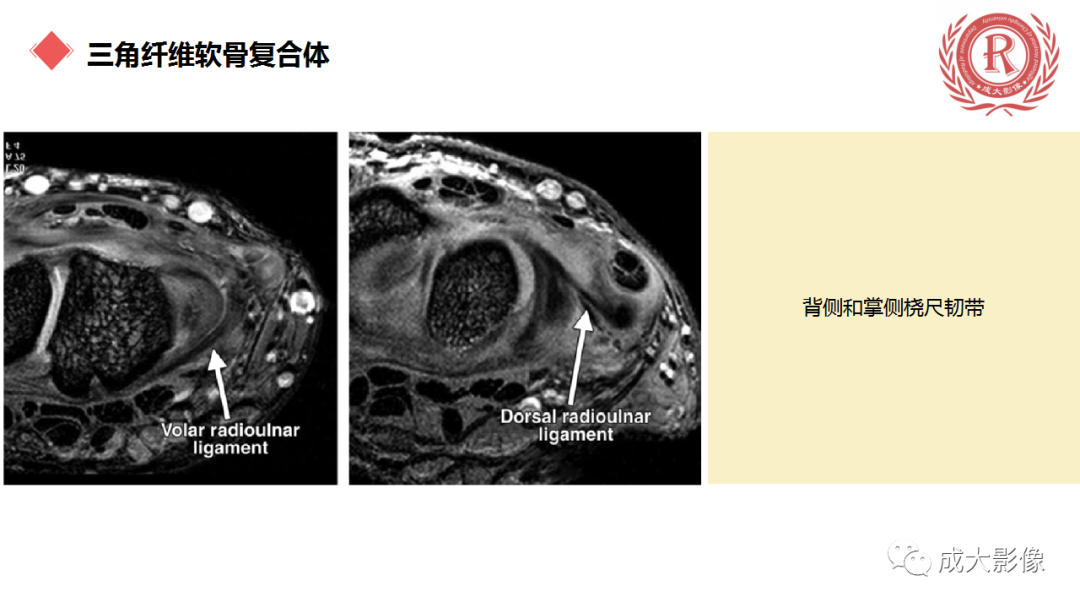影像PPT - 【PPT】腕关节MRI解剖与临床-40