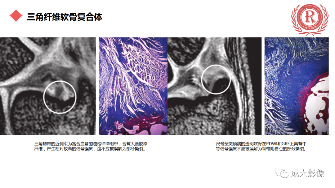 影像PPT - 【PPT】腕关节MRI解剖与临床-42