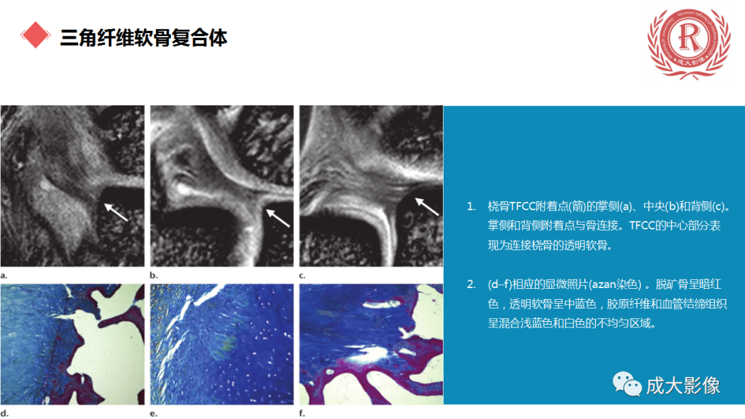 影像PPT - 【PPT】腕关节MRI解剖与临床-43
