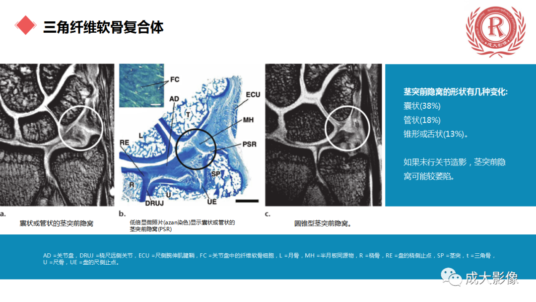 影像PPT - 【PPT】腕关节MRI解剖与临床-45