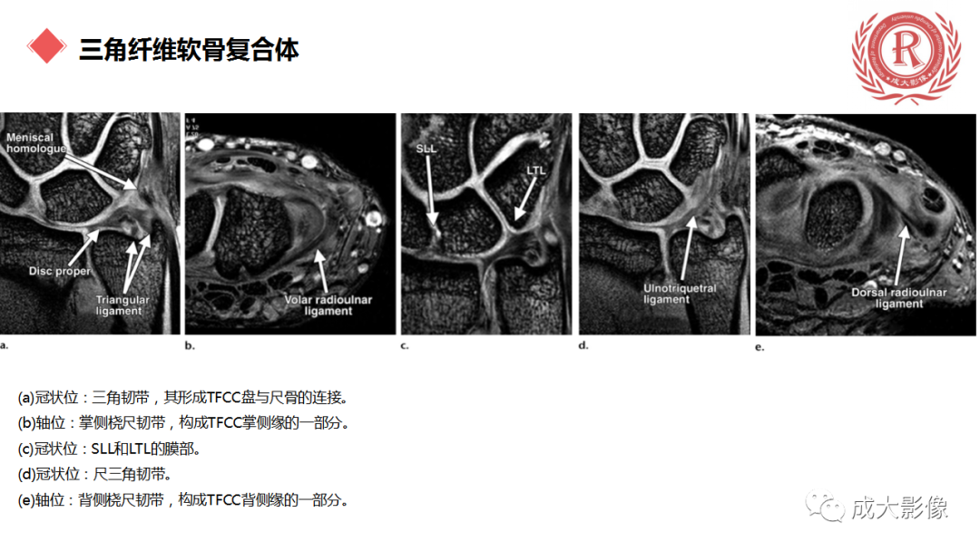 影像PPT - 【PPT】腕关节MRI解剖与临床-44