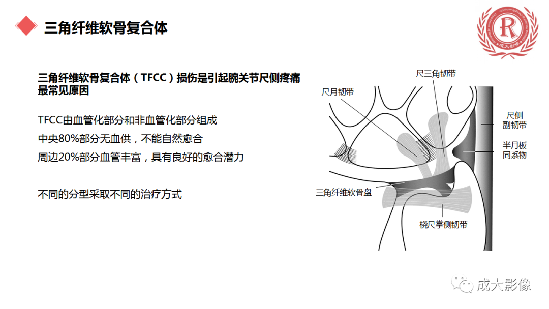 影像PPT - 【PPT】腕关节MRI解剖与临床-48