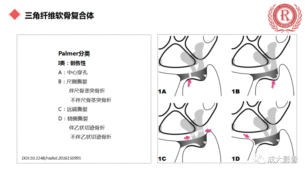 影像PPT - 【PPT】腕关节MRI解剖与临床-49