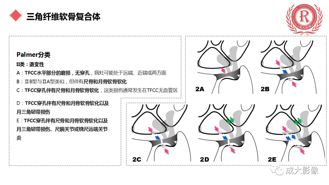 影像PPT - 【PPT】腕关节MRI解剖与临床-55