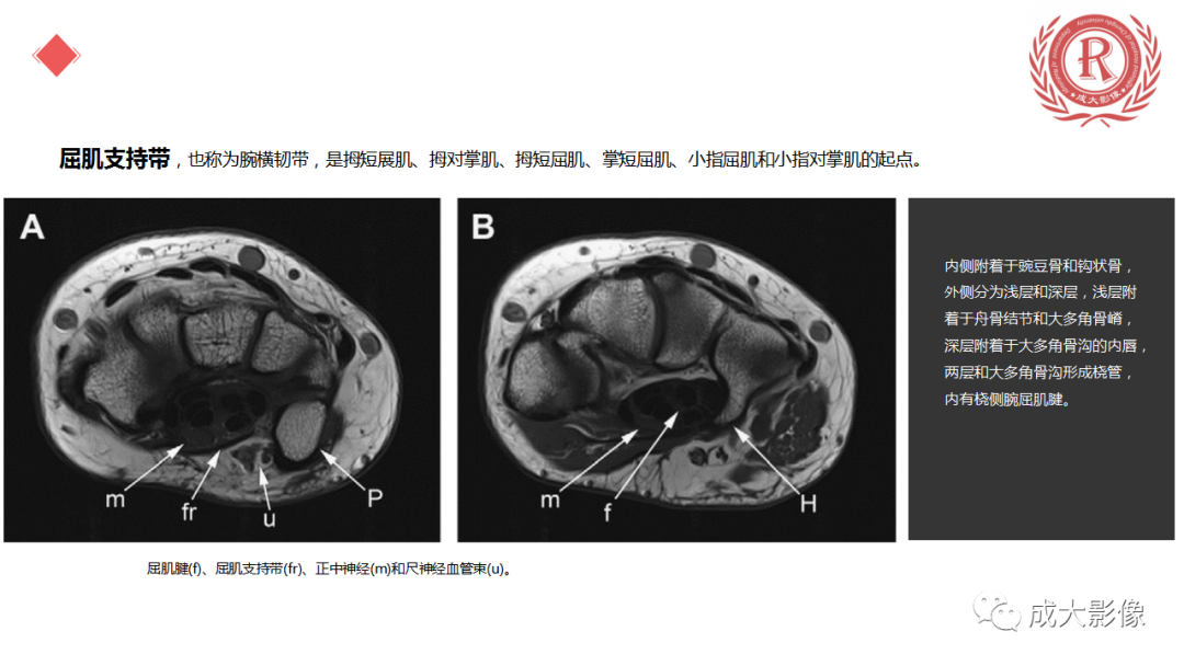 影像PPT - 【PPT】腕关节MRI解剖与临床-58