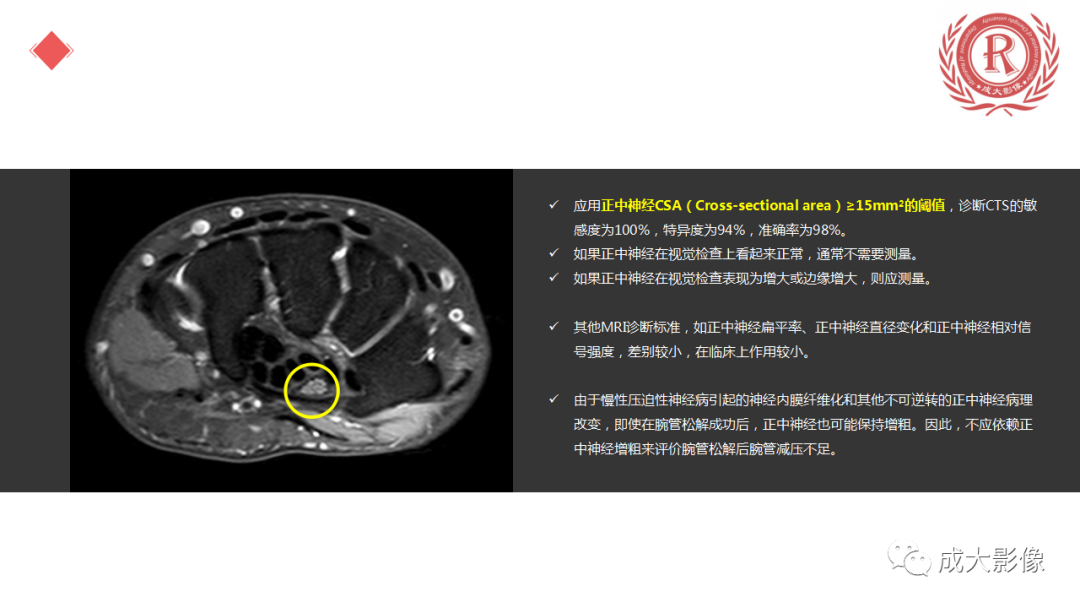 影像PPT - 【PPT】腕关节MRI解剖与临床-61