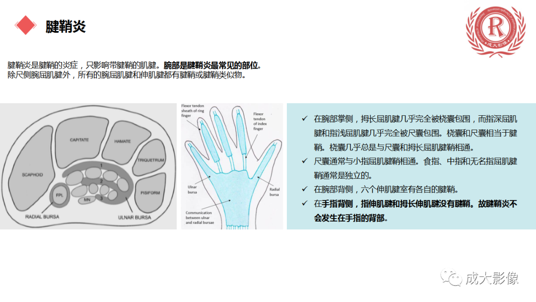 影像PPT - 【PPT】腕关节MRI解剖与临床-63
