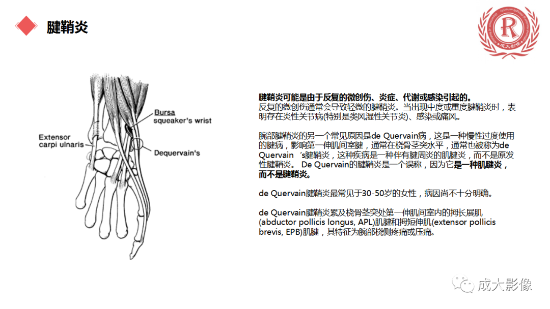 影像PPT - 【PPT】腕关节MRI解剖与临床-65